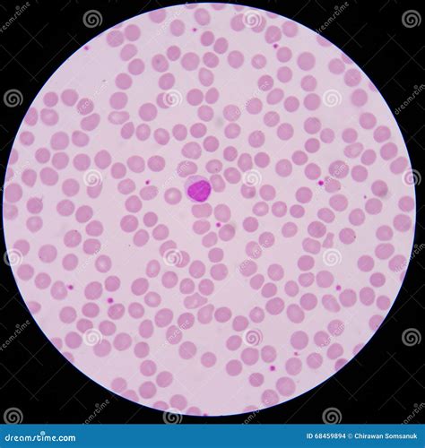 Normal Red Blood Cells Stock Photo Image Of Blood Microbiology 68459894