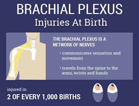 Brachial Plexus Injury Infant