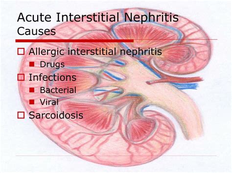 Ppt Acute Renal Failure Powerpoint Presentation Free Download Id