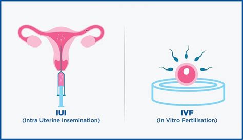 But it's probably a scam. IVF Vs IUI: What Are The Differences Between These ...