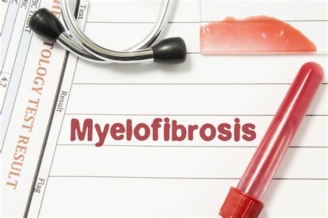 What Is Primary Myelofibrosis Pv Reporter