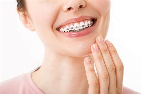 Premium Photo Orthodontic Treatment Dental Care Concept Beautiful Woman Healthy Smile Close Up