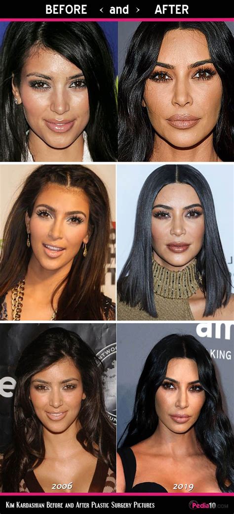 kim kardashian face pics plastic surgery before and a