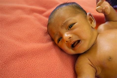 Bayi Kuning Setelah Lahir Kenali Penyebab Dan Cara Mengatasinya Mamabear