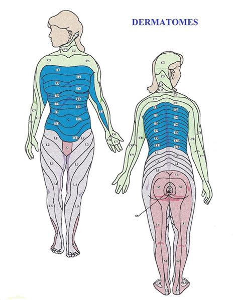 Dermatome Map Shingles Female Dermatomes Chart And Map The Best Porn