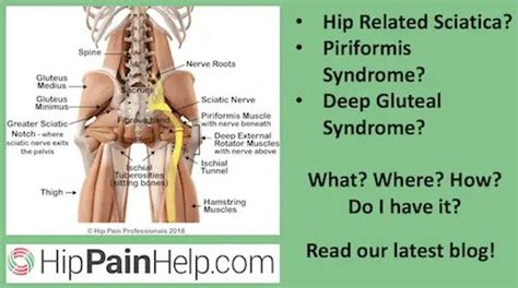 Hip Related Sciatica Piriformis Syndrome And Deep Gluteal Syndrome What Is It What Are The