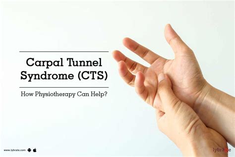 Carpal Tunnel Syndrome Cts How Physiotherapy Can Help By Dr