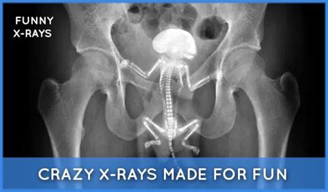 Funny X Ray Littledaybreakerdesigns