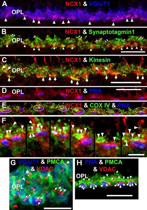 Ncx1 Localizes To Ribbon Synaptic Units Of Cone Pedicles And