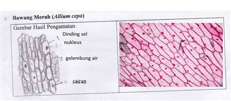 Ketika sel t yang aktif berikatan dengan sel yang demikian, sel t melepaskan protein sitotoksik (seperti perforin) yang dapat membentuk pori pada membran plasma target, membuat ion, air, dan toksin masuk ke dalamnya. Tugas Biologi Sel Tumbuhan | XI IPA R1 | KEL 3