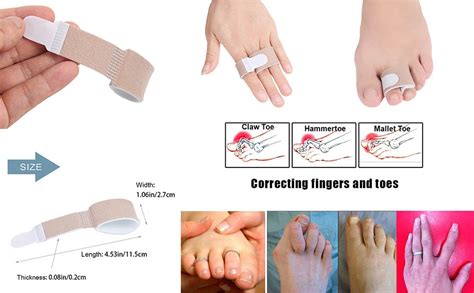 Toe Straighteners Reusabletoe Splints For Bent Toes Hammer Toes