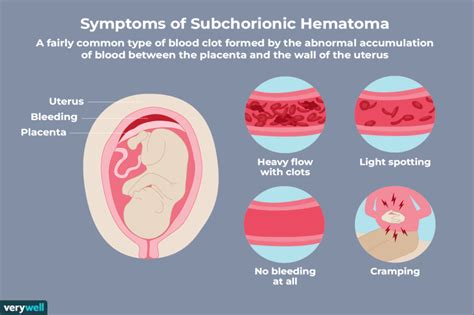 What Is Cause Of Bleeding During Pregnancy
