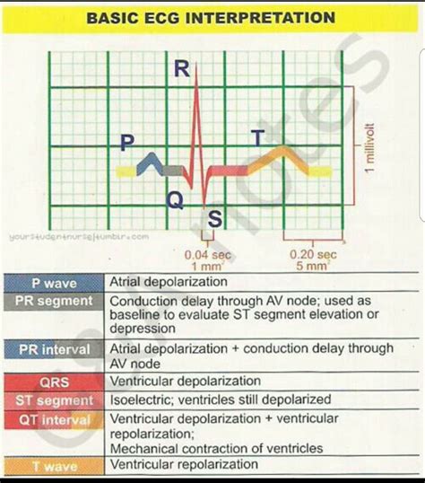 Interpretation Cheat Sheet Ecg Abnormalities Chart