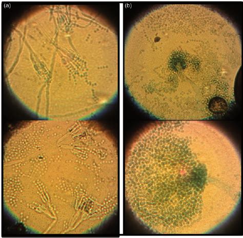 Microscopic Observation Of Fungi A Penicillium Spp And B