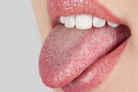 What Do I Need To Know About Dry Mouth Sure Dental