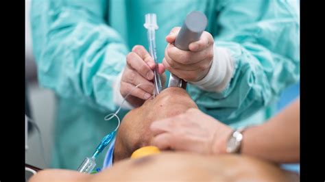 Endotracheal Intubation Procedure Youtube