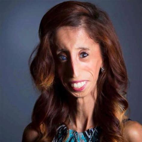 Life News She Was Called The Worlds Ugliest Woman Now Shes An Inspiration Christianity Daily