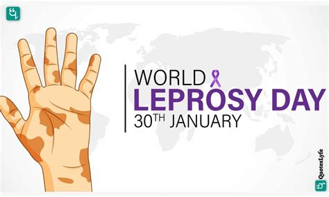 World Leprosy Day 2022 Date Quotes Wishes Messages Images History