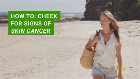 How To Check For Signs Of Skin Cancer Youtube