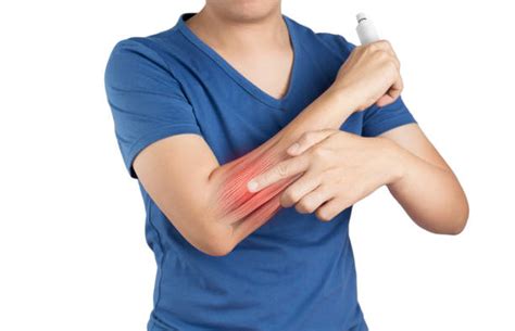 Swollen Arm Stock Photos Pictures And Royalty Free Images Istock