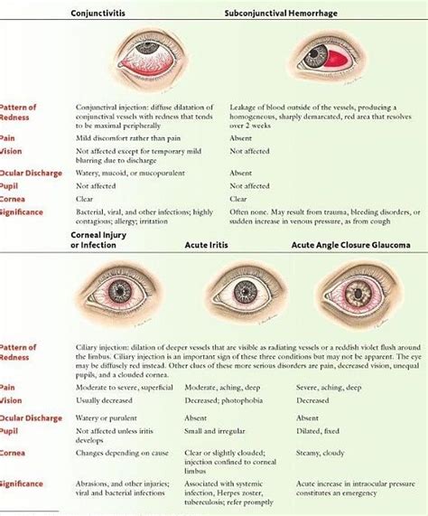Red Eye Differential Dx Opthalmic Technician Eye Facts Medical