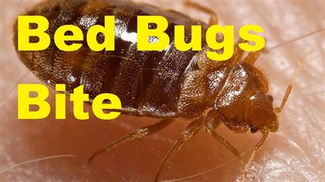 Mild Case Of Bed Bug Bites Bed Bug Bites On Humans Get Rid Of Bed Bugs