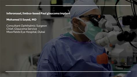 Inferonasal Limbus Based Paul Glaucoma Implant Youtube