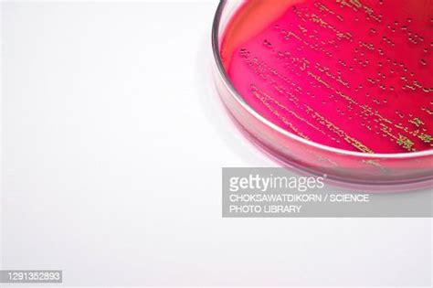 Escherichia Coli Bacteria On Blood Agar High Res Stock Photo Getty Images