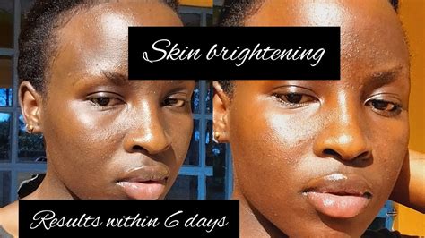 How I Brightened My Face In 6 Days Natural Products Skin Lightening