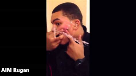 Biggest Cyst Explosion Popping On Face Youtube Youtube
