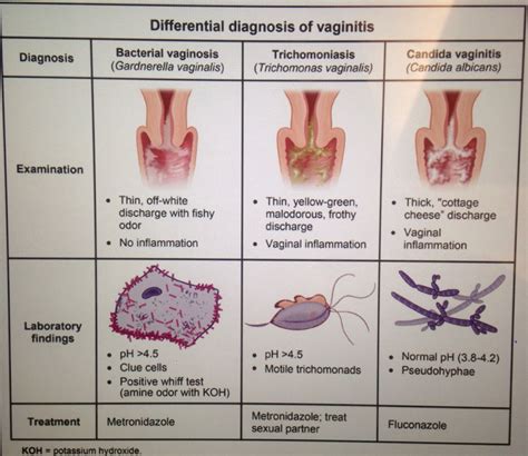 Candidal Vaginitis