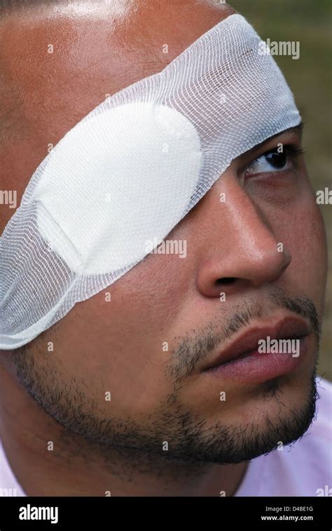 Man Wearing Eye Patch High Resolution Stock Photography And Images Alamy