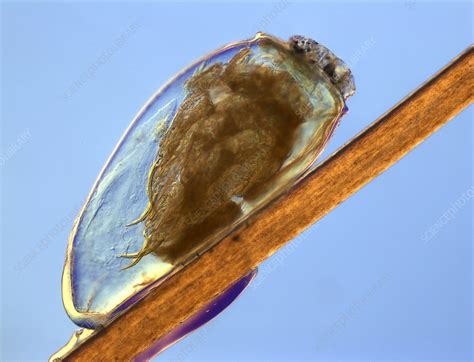 Egg Of Human Head Louse Pediculus Lm Stock Image C0135284 Science