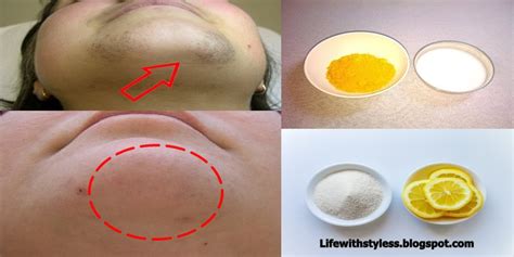 amazing natural home remedy for facial hair removal life with styles