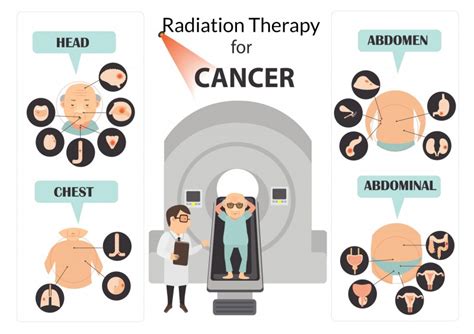 New Cancer Drug Safely Boosts Radiation Therapy Health