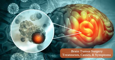 Brain Tumor Surgery Treatments Causes And Symptoms
