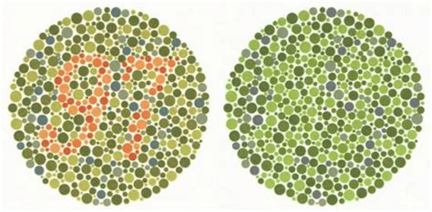 A Test Plate Of The Well Known Ishihara Colour Vision Test Left The