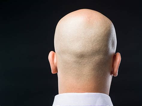 40 Back Of Head Completely Bald Shaved Head Balding Stock Photos