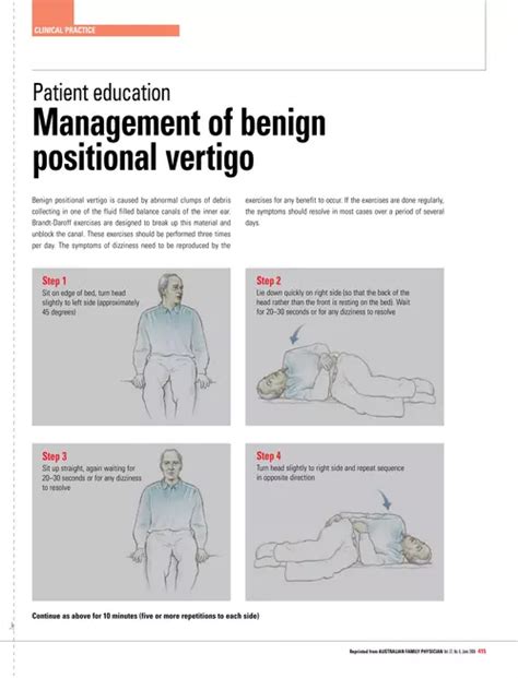 Exercises Patient Education Management Of Benign Positional Vertigo