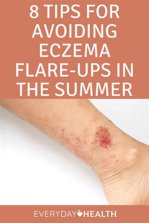 8 Tips For Avoiding Eczema Flare Ups In The Summer Everyday Health In