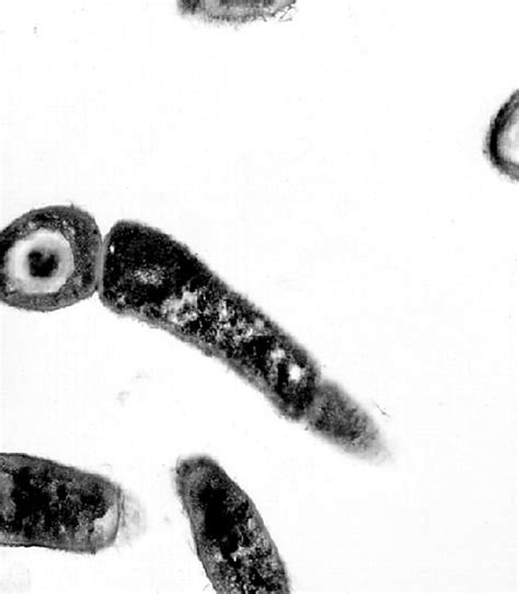 Free Picture Mild Meningitis Hemorrhage Bacillus Anthracis
