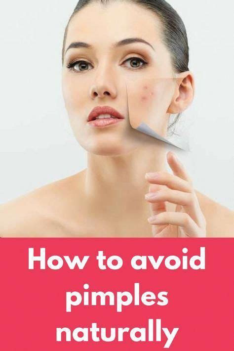 How To Avoid Pimples Naturally How To Avoid Pimples Naturally Easy