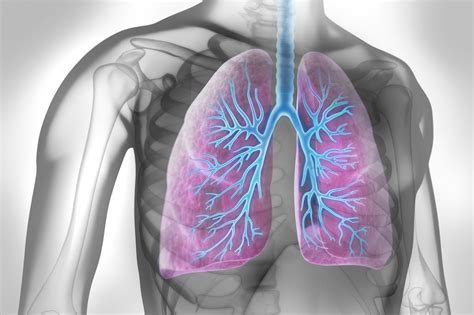 Fewer Cases Of Pulmonary Embolism Diagnosed During Covid 19 Pandemic