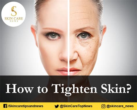 How To Tighten Skin In 2021 Skin Tightening Skin Skin Care