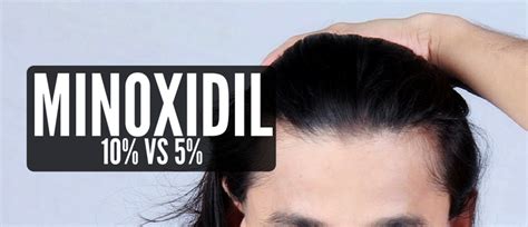 10 Minoxidil Vs 5 Which Is Best For Hair Regrowth Top Hair Loss