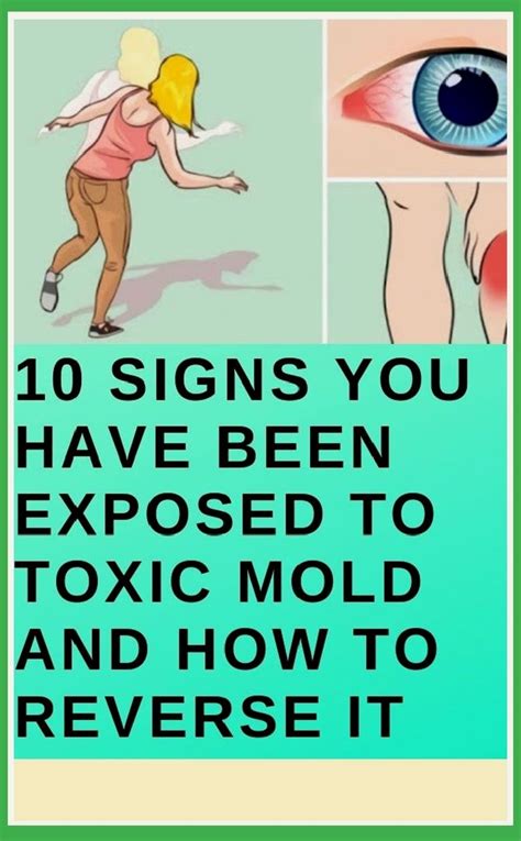 10 Signs You Have Been Exposed To Toxic Mold Healthy Lifestyle