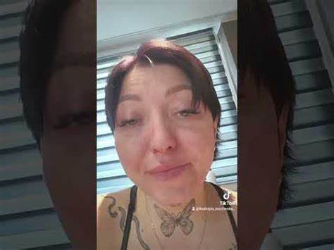 Диета с раком сигмовидной кишки 3-й день 40-й химиотерапии / онкология / рак СИГМОВИДНОЙ КИШКИ 4 СТАДИЯ 3-й день 40-й химиотерапии / онкология / рак СИГМОВИДНОЙ КИШКИ 4 СТАДИЯ Диета с раком сигмовидной кишки