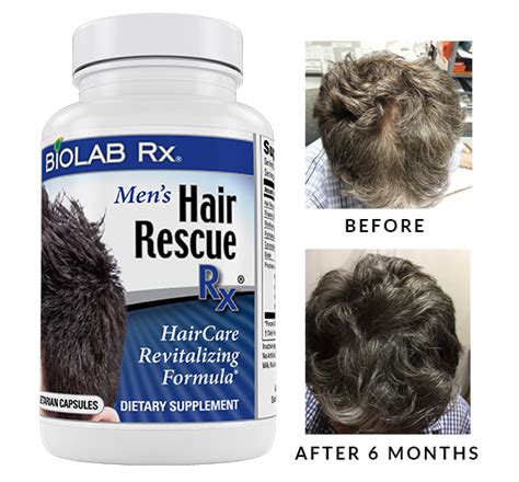 You Can Grow Thick Healthy Hair Naturally Try Hair Rescue Rx You Will