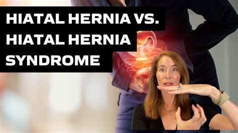 Hiatal Hernia Vs Hiatal Hernia Syndrome Youtube