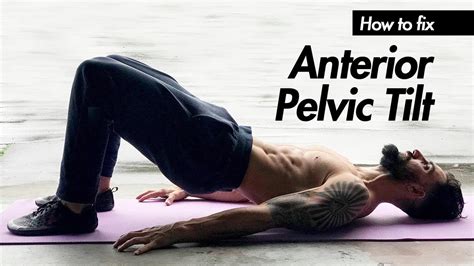 What Is Anterior Pelvic Tilt How Do I FIX Anterior Pelvic Tilt YouTube